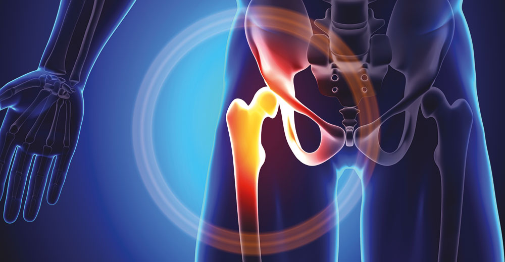 Orthopaedic Surgery - Hip and Knee | Specialities & Treatments at Parkside Suite Frimley